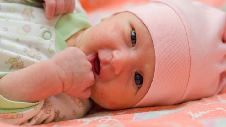 Наиболее распространенные проблемы с кожей у новорожденных