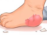 Почему у ребенка шелушатся стопы: причины и как лечить